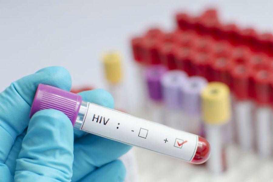 Alcaldía de Ibagué realizará jornadas gratuitas de detección del VIH
