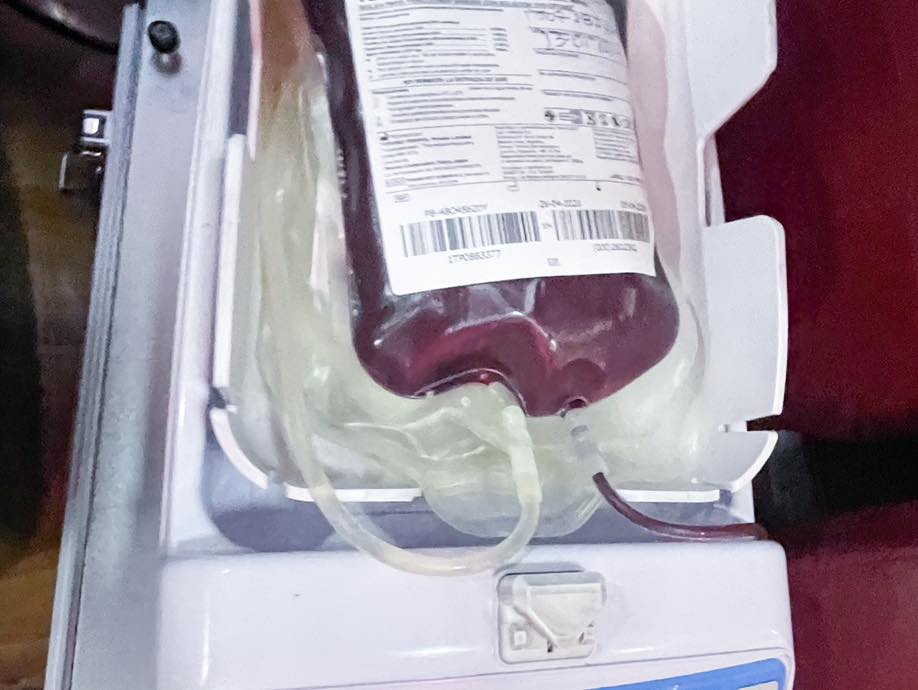 El Federico Lleras Acosta hace un llamado urgente a la donación de sangre esta Semana Santa ante el aumento del dengue y otras patologías