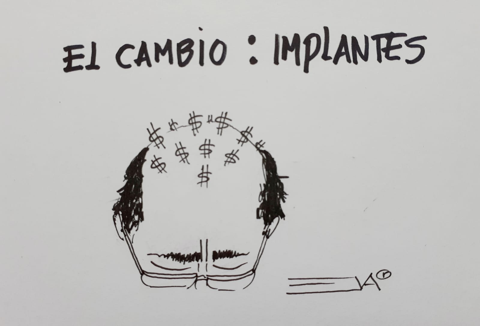 EL CAMBIO : IMPLANTES