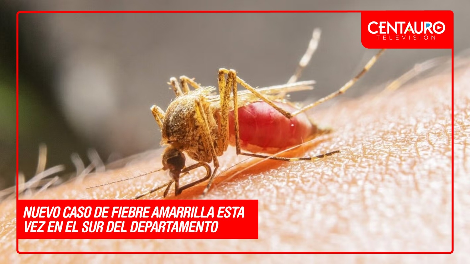 Nuevo caso de fiebre amarilla en el sur del Tolima enciende las alarmas